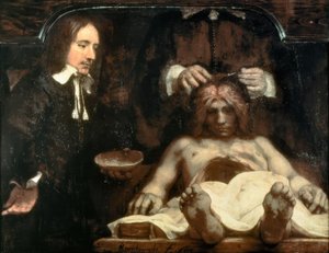 Anatomie Dr. Johan Deijman od Rembrandt van Rijn