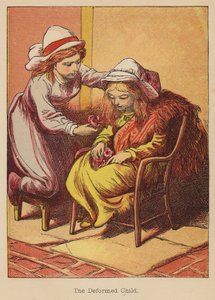 Deformované dítě (kolorovaná rytina)
