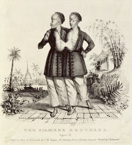 Siamští bratři, 18 let, tisk Charles Hullmandel (1789-1850), kolem 1829