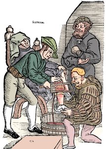 Amputace nohy bez anestetika, 1593 od Unbekannt