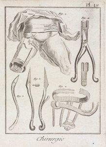 Raná moderní ortopedická chirurgie od Unbekannt