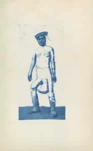 Elefantiáza