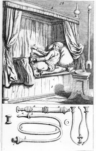 Clystère (pro klystýry) od Johannese Sculpteta „“Armamentarium Surgical““. Benátky 1665 od Unknown artist