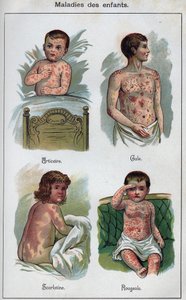 Nemoci dětí: Kopřivka, spalničky, svrab, spála. In „Nová přírodní léčba“ od F.E. Bilze. od Unknown artist