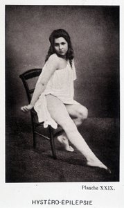 Hystero Epilepsie - Kontraktura v „“ Fotografické ikonografii Salpétrière: služba pana Charcota“ od Paula Regnarda a Bourneville od Unknown artist