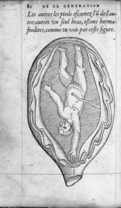 Poloha plodu v děloze během těhotenství. Rytina z „“De la generation des enfants““ od francouzského lékaře a chirurga Ambroise Pare (1509-1590) 16. století od Unknown artist