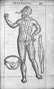 Medicína: kýlní pás. Rytina z „“ De la hargne““ od francouzského lékaře a chirurga Ambroise Pare (1509-1590) 16. století od Unknown artist