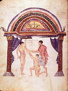 Medicína: redukce vykloubeného lokte, pacient je pověšen za paži (rukopis od Unknown artist