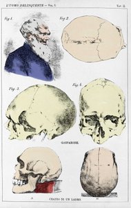 Studie o morfologii delikventní lebky od italského kriminologa od Unknown artist