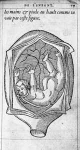 Poloha plodu v děloze během těhotenství. Rytina z „“De la generation des enfants““ od francouzského lékaře a chirurga Ambroise Pare (1509-1590) 16. století od Unknown artist