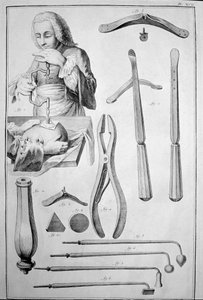 Trepanace lebky, různé nástroje (rytina od Unknown artist