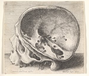 Řez lebky z profilu vlevo s odstraněnou levou stranou lebky, 1651. od Wenceslaus Hollar