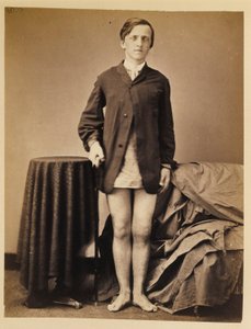 Vojín G. W. Warrington, zotavení bez amputace po střelné zlomenině pravé pately, z fotografického katalogu chirurgické sekce