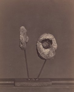 Vyříznutý kolenní kloub. Kulatá mušketová koule ve vnitřním kondylu pravé stehenní kosti [Gardin..., 1866-67.