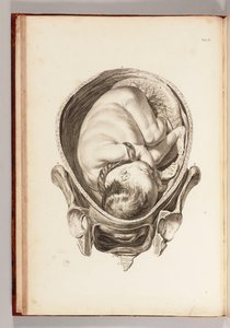 Rytina dítěte v lůně ze „Souboru anatomických tabulek, s vysvětlivkami a zkrácením praxe porodní asistence“, 1754 od William Smellie