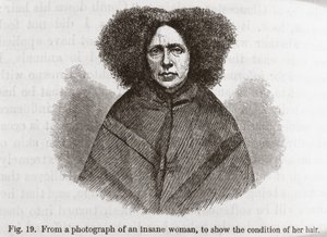 Psychiatrie Šílená žena od Frederick (attr. to) Barnard