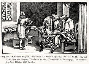 Německý chirurg, z Consolation of Philosophy od Boethia, ilustrace z Vědy a literatury ve středověku a renesanci, napsal a vyryl Paul Lacroix, 1878 (bw ph