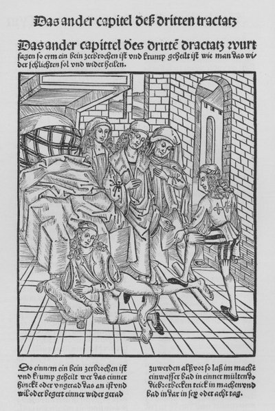 Kniha Cirurgia od Hieronyma Brunschwiga (litho) od (after) German School