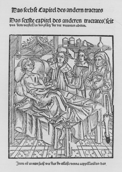 Kniha Cirurgia od Hieronyma Brunschwiga (litho) od (after) German School