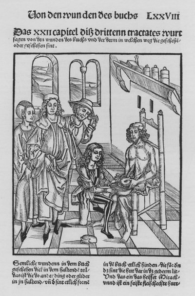 Kniha Cirurgia od Hieronyma Brunschwiga (litho) od (after) German School
