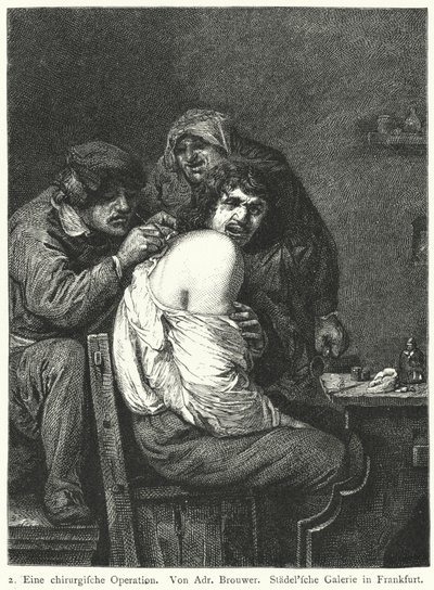 Operace zad od Adriaen (after) Brouwer