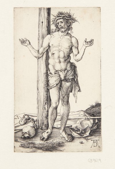 Muž bolesti se zdviženýma rukama od Albrecht Dürer