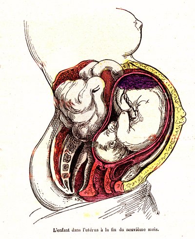 Dítě v děloze (konec 9. měsíce) - Normální život a zdraví J. Rengada - Kresba A. Demarle 1881 od Alphonse Demarle