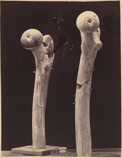 Vzorky střelných zlomenin stehenní kosti,c. 1867 (foto) od American Photographer