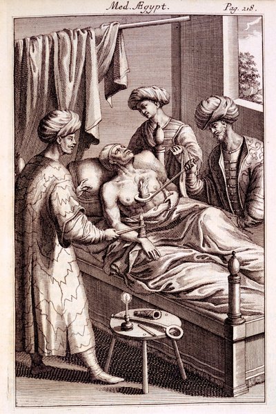 Ilustrace moxování z Medicina Aegyptorum od Prospero Alpinus, 1745 od American School