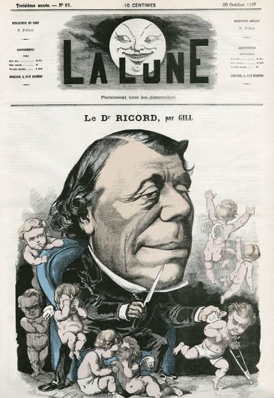 Portrét doktora Ricorda, francouzského lékaře. Cartoon by Gill, v „La Lune“, 20. října od Andre Gill