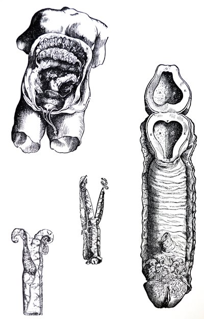 Desky z páté knihy De Humani Corporis Fabrica od Andreas Vesalius