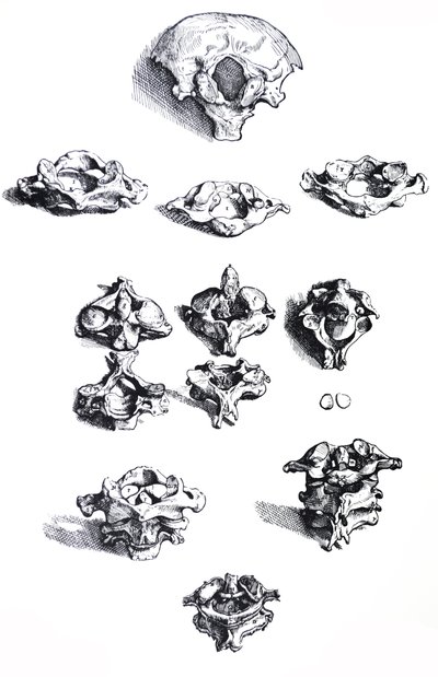 Desky z první knihy De Humani Corporis Fabrica od Andreas Vesalius