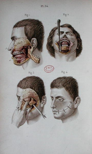 Anatomická deska horní čelisti od C and Huette E. Bernard