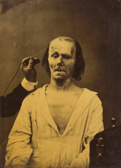 Uvolněná tvář vlevo, hluboká pozornost vpravo, 1854-1856, tištěno 1862. od Duchenne de Boulogne