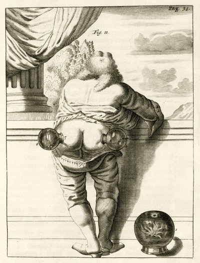 Příklad baňkování z The Practice of Medicine od Frederika Dekkerse, 1694 od Dutch School