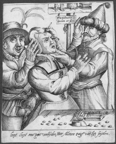 Trepanning, rytina H. Weydmanse (16. století) od Dutch School