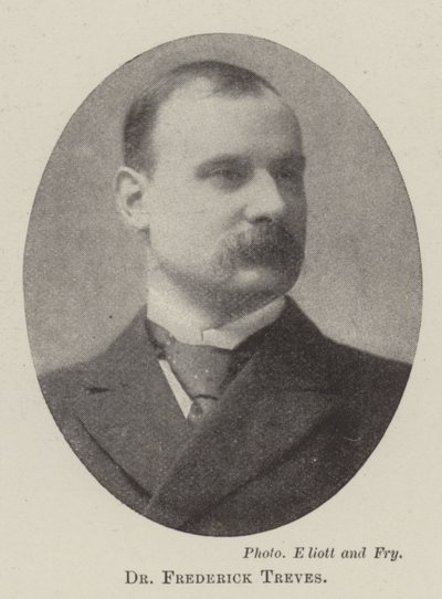 doktor Frederick Treves od English Photographer