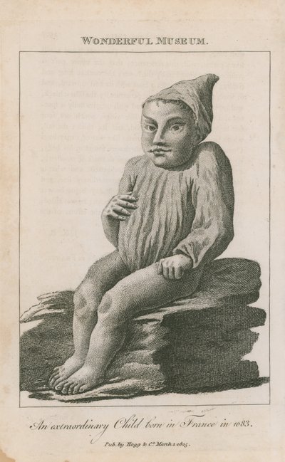 Mimořádné dítě narozené ve Francii v roce 1683 od English School