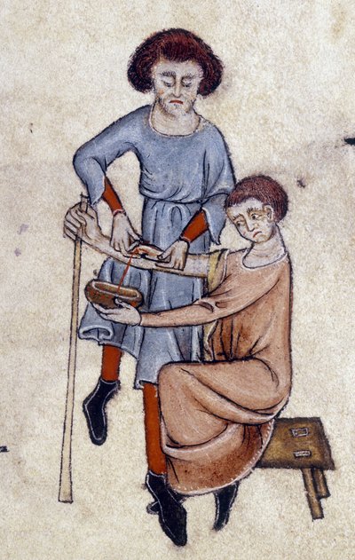 Propouštění krve, z Luttrellova žaltáře, c.1325-35 (vellum) od English School