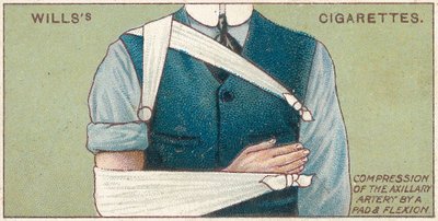 Komprese axilární tepny podložkou a flexí, č. 41 ze série karet Wills