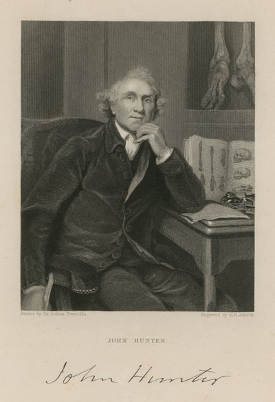 John Hunter od English School