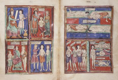 Sloane 1975 fol.91v-92 Lékařské scény od English School