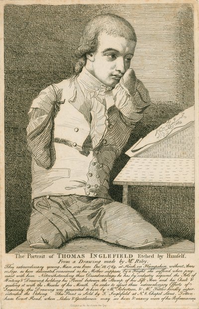 Thomas Inglefield, narozen 18. prosince 1769 v Hook, Hampshire, bez rukou a nohou od English School