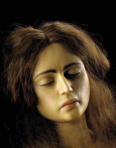 Anatomický model ovariálního těhotenství, detail od European School