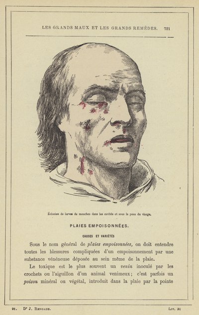 Líhnutí larev much v dutinách a pod kůží obličeje (barva lito) od French School
