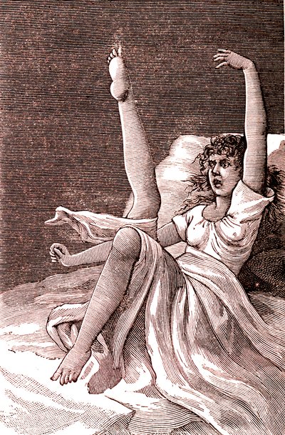 Hysterie, extrémně duševní jev, psychózy a psychoneuróza. 1887 (rytina) od French School