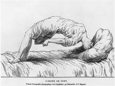 Hysterie a somnambulismus, z Les Maladies Epidemiques de lEsprit od Paula Regnarda (1850-1927) 1884 od French School
