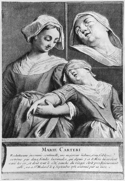 Zázračné uzdravení slepé ženy Marie Carteri na hrobě jáhna Francoise de Paris na farním hřbitově Saint-Medard v Paříži. od French School