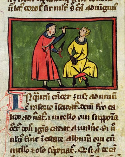 Paní H 89 Chirurgická léčba, z edice Book of Surgery od Rogiera de Salerne od French School
