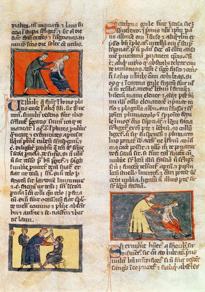 Paní H 89 fol. 17r Chirurgie, z vydání „Knihy chirurgie“ od Rogiera de Salerne od French School